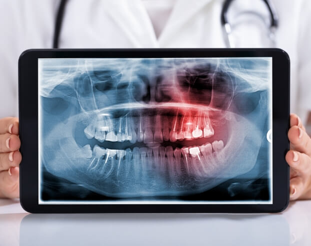 Digital dental x-rays on tablet computer