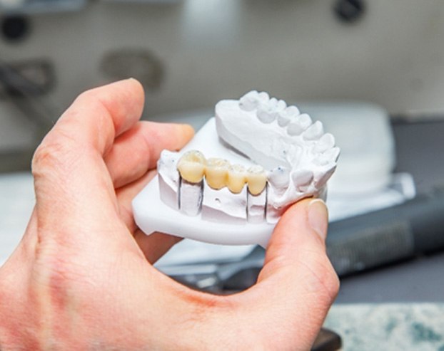 A close-up of a dental bridge in downtown Boston