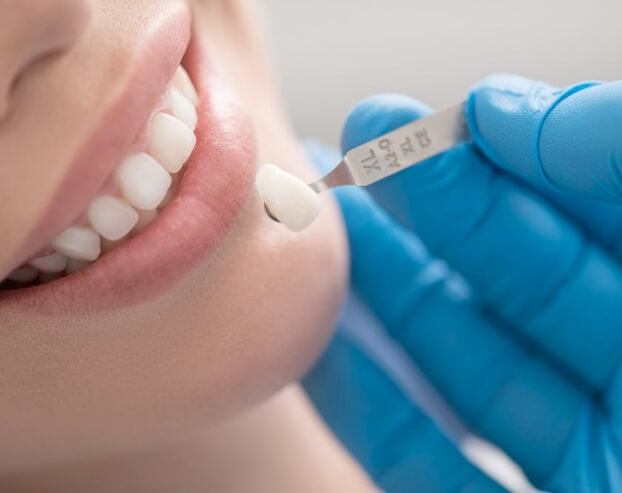 Dentist comparing patient's smile to dental restoration shade option
