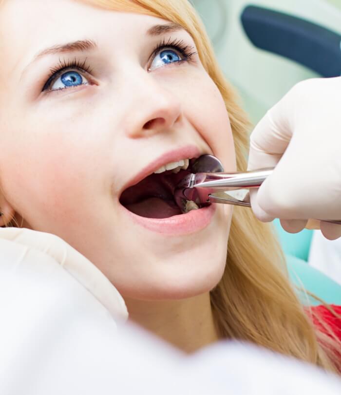 Dental patient receiving tooth extraction