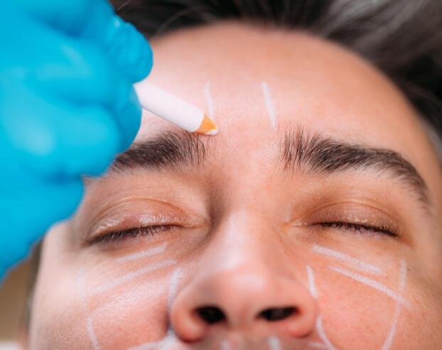 Dentist preparing treatment lines on patient’s face  