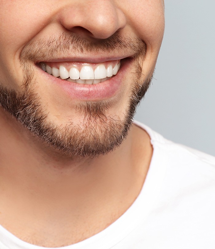 Gum recontouring can make your smile appear bigger
