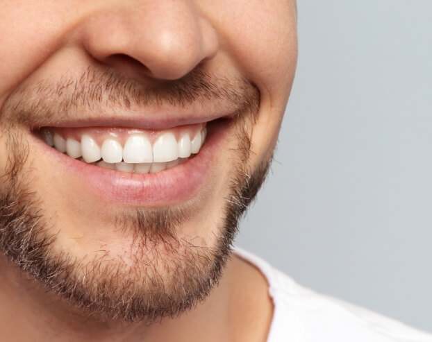 CLoseup of patient's flawless smile after full mouth reconstruction