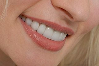 Closeup of healthy smile