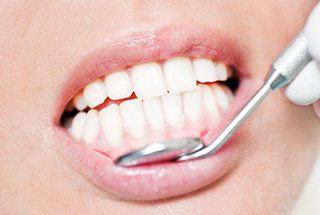Closeup of smile during gum disease screening