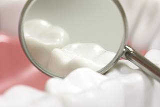 Closeup of tooth following cavity treatment