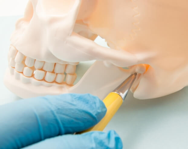 Model of jaw and skull bone depicting need for T M J therapy