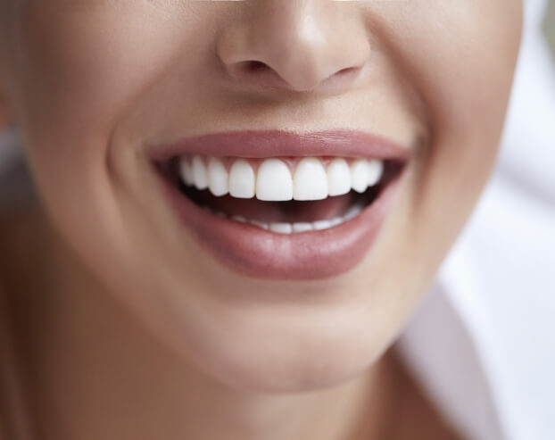 Dental patient with flawless smile after porcelain veneers