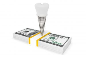 dental implant on money