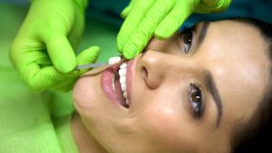 woman smiling having veneers placed