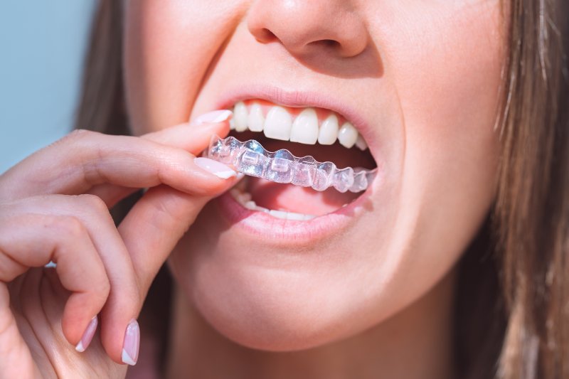 woman wearing Invisalign in Boston