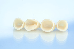Close-up of four dental crowns lying on their side